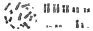 хромосомний набір Sicista severtzovi